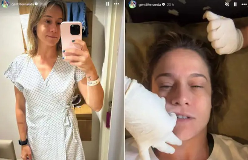  Atriz Fernanda Gentil mostra tratamento para conter paralisia facial